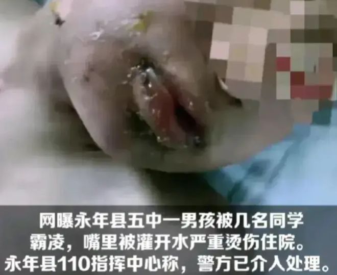 包含社区盾今晚走向成谜，上海海港豪取连胜，质疑声仍在，医务组通报恢复的词条